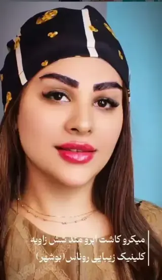 بعد از میکروکاشت ابرو متد شش‌زاویه