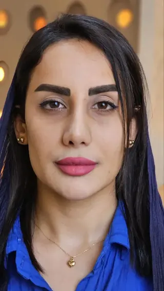 قبل از تزریق فول‌فیس